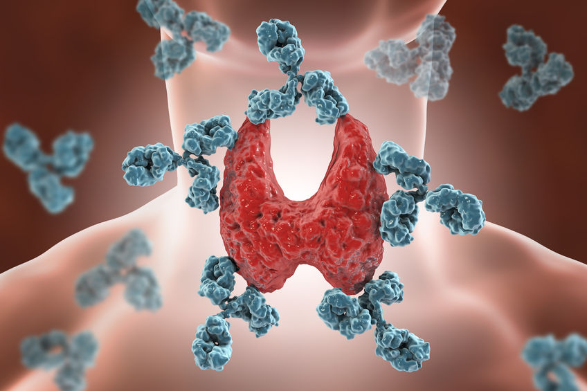 autoimmune thyroiditis, hashimoto's disease. 3d illustration showing antibodies attacking thyroid gland