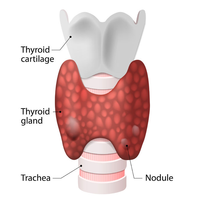 thyroid nodules and goiters. anatomy of the thyroid gland (included throat, thyroid gland and trachea)