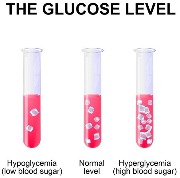 blood sugar level or glucose level. normal level, hyperglycemia and hypoglycemia. test-tube with blood