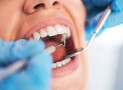 Can Dental Work, Such as Fillings, Lead to Thyroid Issues?