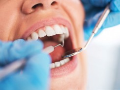 Can Dental Work, Such as Fillings, Lead to Thyroid Issues?
